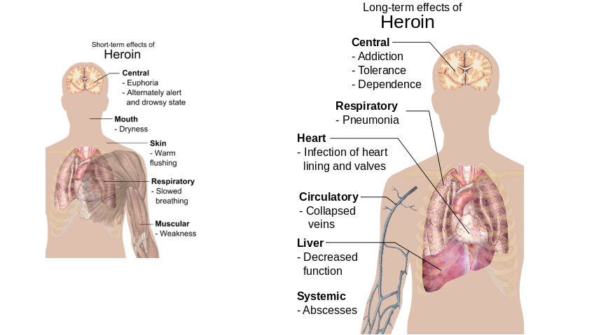 affects of heroin abuse