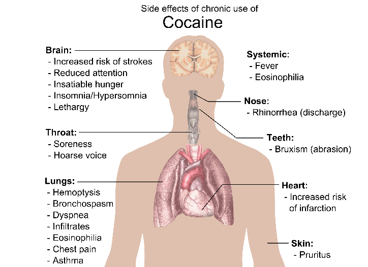 side effects of using cocaine